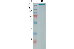 SDS-PAGE (SDS) image for phospholipase A2 Receptor 1, 180kDa (PLA2R1) (AA 21-1397) protein (His tag) (ABIN7538471)