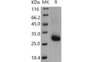 Western Blotting (WB) image for TIMP Metallopeptidase Inhibitor 1 (TIMP1) (Active) protein (ABIN7198251) (TIMP1 Protein)