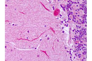 Anti-IGF2 antibody IHC of human brain, cerebellum, Purkinje. (IGF2 Antikörper)