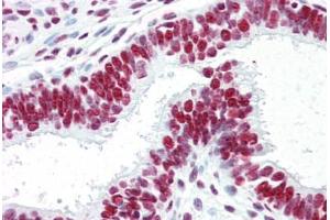 Human Uterus (Formalin-Fized, Paraffin-Embedded) stained with ACIN1 antibody ABIN461879 at 5 ug/ml followed by biotinylated goat anti-rabbit IgG secondary antibody ABIN481713, alkaline phosphatase-streptavidin and chromogen. (ACIN1 Antikörper)