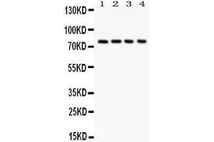 Anti-Tau antibody, Western blotting All lanes: Anti  at 0. (MAPT Antikörper  (N-Term))