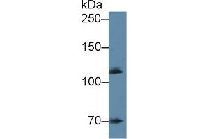 Detection of ADD1 in Mouse Cerebrum lysate using Polyclonal Antibody to Alpha Adducin (ADD1) (alpha Adducin Antikörper  (AA 388-560))