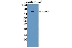 Western Blotting (WB) image for anti-Matrix Metallopeptidase 15 (Membrane-inserted) (MMP15) (AA 280-497) antibody (ABIN1862908) (MMP15 Antikörper  (AA 280-497))