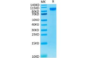 Human ENPP-2 on Tris-Bis PAGE under reduced condition. (ENPP2 Protein (His tag))