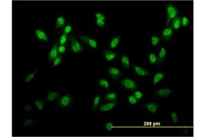 Immunofluorescence of monoclonal antibody to USF2 on HeLa cell.
