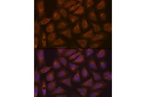 Immunofluorescence analysis of U-2 OS cells using CAD Rabbit mAb (ABIN7266064) at dilution of 1:100 (40x lens). (CAD Antikörper)