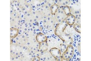 Immunohistochemistry of paraffin-embedded Mouse kidney using MTERFD3 Polyclonal Antibody at dilution of 1:100 (40x lens). (MTERFD3 Antikörper)