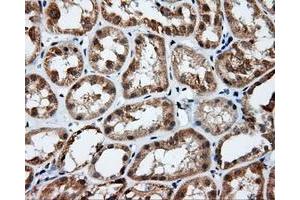 Immunohistochemical staining of paraffin-embedded prostate tissue using anti-RC201933 mouse monoclonal antibody. (PIM2 Antikörper)