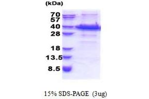 SDS-PAGE (SDS) image for Fibronectin Type III and Ankyrin Repeat Domains 1 (FANK1) (AA 1-345) protein (His tag) (ABIN5853371)