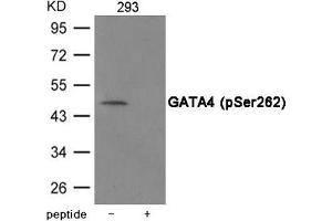 Western blot analysis of extracts from 293 cells using GATA4 (Phospho-Ser262) Antibody. (GATA4 Antikörper  (pSer262))
