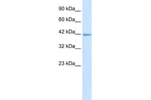 Western Blotting (WB) image for anti-IKAROS Family Zinc Finger 2 (IKZF2) antibody (ABIN2460270) (IKZF2 Antikörper)