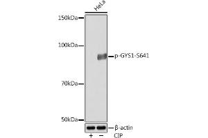 Western blot analysis of extracts of various cell lines, using Phospho-GYS1-S641 Rabbit mAb (ABIN7270761) at 1:1000 dilution. (Glycogen Synthase 1 Antikörper  (pSer641))
