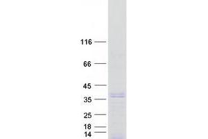 Western Blotting (WB) image for SIX Homeobox 2 (SIX2) protein (Myc-DYKDDDDK Tag) (ABIN2732098)