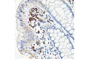 Immunohistochemistry of paraffin-embedded human colon using CD68 Rabbit pAb (ABIN6132070, ABIN6138218, ABIN6138221 and ABIN6217224) at dilution of 1:50 (40x lens). (CD68 Antikörper  (AA 22-319))