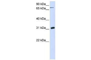 Western Blotting (WB) image for anti-Uridine Phosphorylase 1 (UPP1) antibody (ABIN2458626) (UPP1 Antikörper)
