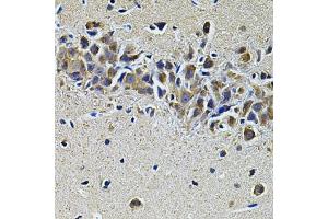 Immunohistochemistry of paraffin-embedded mouse brain using PLCG1 Antibody. (Phospholipase C gamma 1 Antikörper)