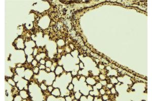 ABIN6269336 at 1/100 staining Mouse lung tissue by IHC-P. (FOXO1 Antikörper  (Internal Region))