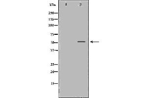 Western blot analysis of LoVo cell lysate, using MMP13 Antibody.