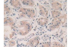 Immunohistochemistry (IHC) image for anti-Vascular Endothelial Growth Factor A (VEGFA) (AA 28-147) antibody (ABIN7429445)