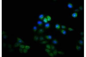 Immunofluorescence staining of Hela cells with ABIN7157464 at 1:133, counter-stained with DAPI. (KRT8 Antikörper  (AA 2-483))