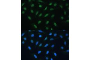 Immunofluorescence analysis of U-2 OS cells using  antibody (ABIN6127378, ABIN6137233, ABIN6137235 and ABIN6217480) at dilution of 1:100. (ATF3 Antikörper  (AA 1-181))