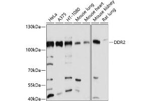 Western blot analysis of extracts of various cell lines, using DDR2 antibody (ABIN6130247, ABIN6139473, ABIN6139474 and ABIN6214178) at 1:1000 dilution. (DDR2 Antikörper  (AA 290-400))