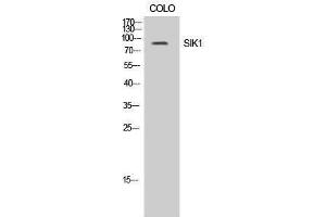 Western Blotting (WB) image for anti-Salt-Inducible Kinase 1 (SIK1) (Tyr86) antibody (ABIN3186959) (SIK1 Antikörper  (Tyr86))