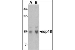 Western blot analysis of op18 in human brain tissue lysate with this product at (A) 0. (Stathmin 1 Antikörper  (N-Term))