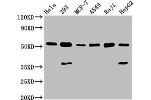 Western Blot Positive WB detected in: Hela whole cell lysate, 293 whole cell lysate, MCF-7 whole cell lysate, A549 whole cell lysate, Raji whole cell lysate, HepG2 whole cell lysate All lanes: SMAD1 antibody at 3 μg/mL Secondary Goat polyclonal to rabbit IgG at 1/50000 dilution Predicted band size: 53, 16 kDa Observed band size: 53 kDa (SMAD1 Antikörper  (AA 202-335))