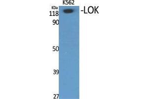 Western Blot (WB) analysis of specific cells using LOK Polyclonal Antibody. (STK10-A Antikörper  (Internal Region))