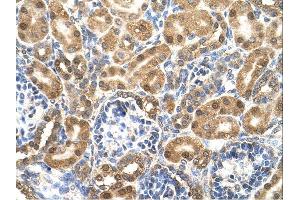 Enolase 3 antibody was used for immunohistochemistry at a concentration of 4-8 ug/ml. (ENO3 Antikörper)