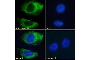 ABIN185358 Immunofluorescence analysis of paraformaldehyde fixed HeLa cells, permeabilized with 0.