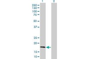 Western Blot analysis of AHNAK expression in transfected 293T cell line by AHNAK MaxPab polyclonal antibody. (AHNAK Antikörper  (AA 1-149))