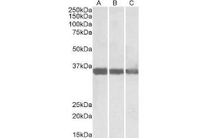 ABIN1590066 (0. (MDH1 Antikörper  (Internal Region))