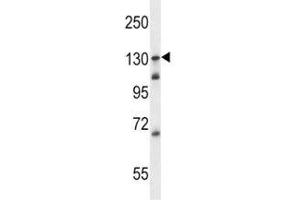 TLR9 antibody western blot analysis in Ramos lysate (TLR9 Antikörper  (AA 842-870))