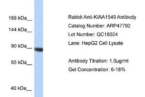 WB Suggested Anti-KIAA1549 Antibody   Titration: 1.