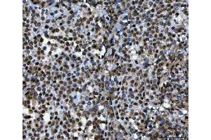 IHC analysis of TIP49A/RUVBL1 using anti-TIP49A/RUVBL1 antibody (ABIN7599928). (RUVBL1 Antikörper  (AA 13-23))