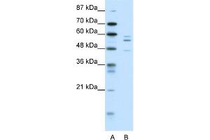 WB Suggested Anti-PAX6 Antibody Titration:  0. (PAX6 Antikörper  (N-Term))