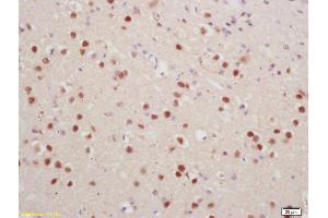 Formalin-fixed and paraffin embedded rat brain labeled with Anti-phospho-Histone H1. (HIST1H1E Antikörper  (pThr18))