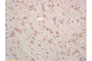 Formalin-fixed and paraffin embedded rat brain labeled with Rabbit Anti ARP3 Polyclonal Antibody, Unconjugated (ABIN1387419) at 1:200 followed by conjugation to the secondary antibody and DAB staining