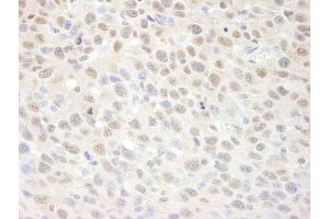 Immunohistochemistry (IHC) image for anti-Suppressor of Ty 6 Homolog (SUPT6H) (AA 425-475) antibody (ABIN7448820)