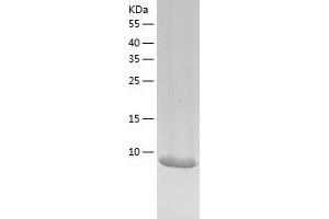 Chromodomain Protein, Y-Linked, 1 (CDY1) (AA 2-90) protein (His-IF2DI Tag)