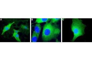 Immunocytochemistry (ICC) image for anti-Uncoupling Protein 2 (Mitochondrial, Proton Carrier) (UCP2) (AA 153-164), (Intracellular) antibody (ABIN7043873)