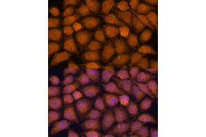 Immunofluorescence analysis of HeLa cells using TNFL2 antibody (ABIN6133093, ABIN6149298, ABIN6149299 and ABIN6217788) at dilution of 1:100. (TNFAIP8L2 Antikörper  (AA 1-184))
