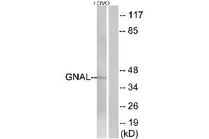 Immunohistochemistry analysis of paraffin-embedded human brain tissue using GNAL antibody. (GNAL Antikörper  (Internal Region))
