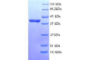 SDS-PAGE (SDS) image for Annexin A3 (ANXA3) (AA 5-322), (partial) protein (His tag) (ABIN5713074)