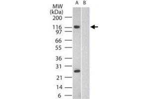 Western blot analysis of SIK2 in human brain in the A) absence and B) presence of immunizing peptide, using SIK2 polyclonal antibody  at 2 ug/mL . (SIK2 Antikörper  (AA 100-150))