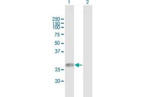 Western Blot analysis of TPD52L2 expression in transfected 293T cell line by TPD52L2 MaxPab polyclonal antibody. (TPD52L2 Antikörper  (AA 1-206))