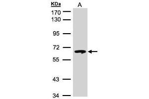 WB Image Sample(30 μg of whole cell lysate) A:Hep G2, 7. (GBA Antikörper  (C-Term))