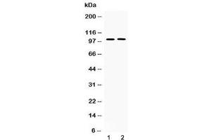 Western blot testing of 1) rat lung and 2) human PANC1 lysate with PDE5A antibody at 0.